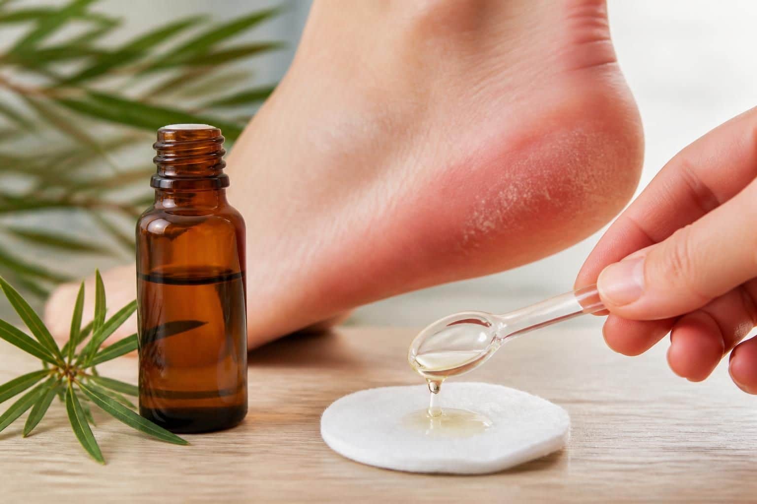 découvrez comment utiliser l'huile essentielle de tea tree pour traiter efficacement les mycoses et infections, avec des conseils pratiques et précautions d'emploi.